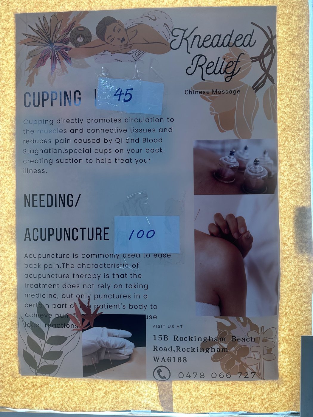 Kneaded Relief's own window poster listing cupping for $45 and acupuncture for $100